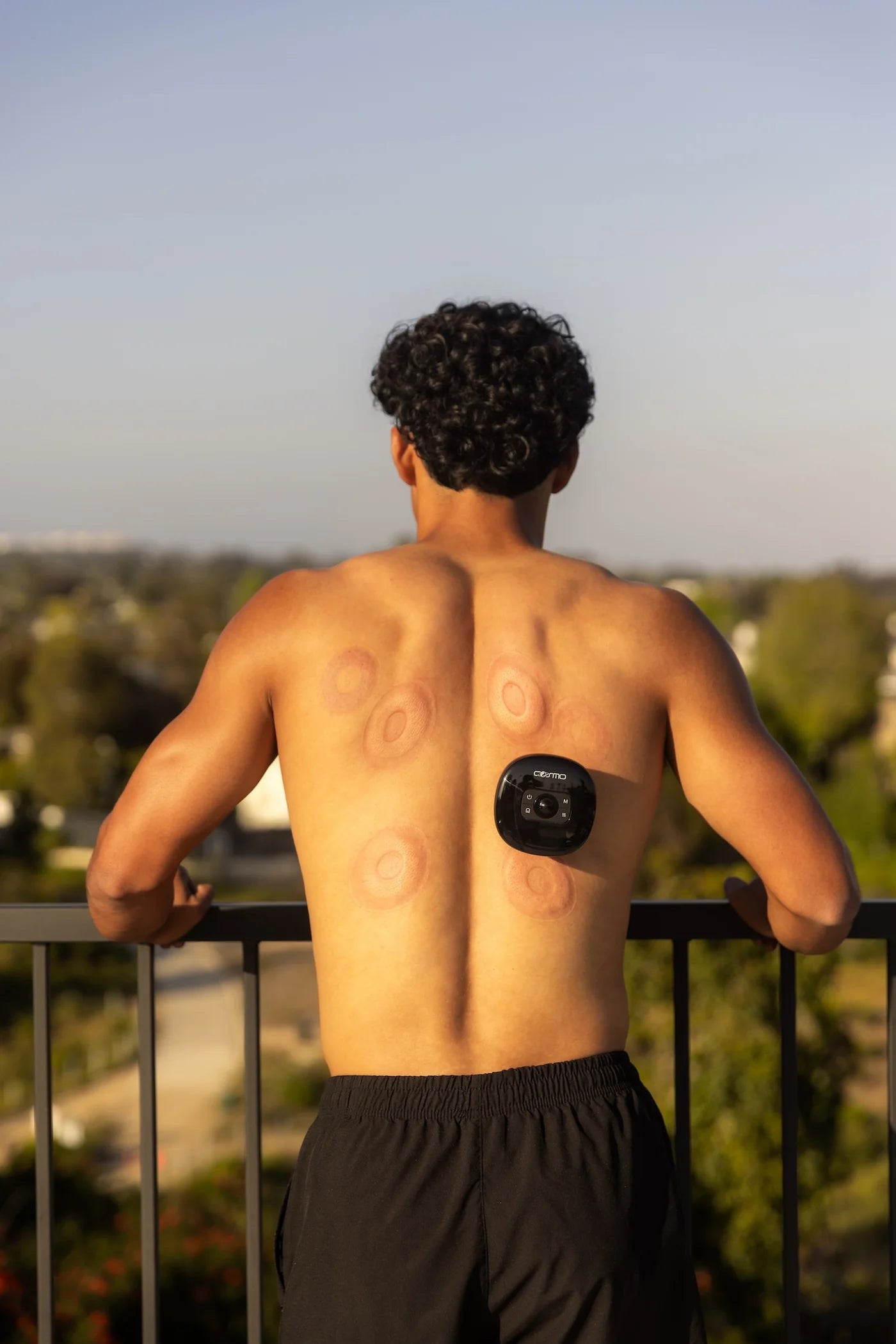 Man with cupping marks and Novacup device overlooking a view